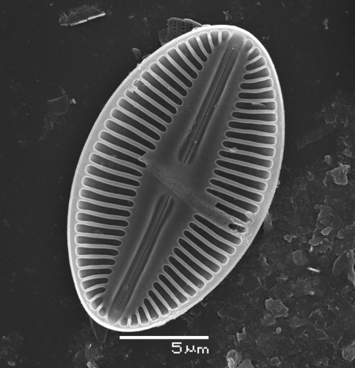 <p>Глянем на хорошо известное через электронные микроскопы - просвечивающий, он же трансмиссионный &nbsp;(ТЭМ) и сканирующий (СЭМ). Здорово, правда?</p>
<p><br />СЭМ и ТЭМ-микрофотографии любезно предоставлены коллегами с Биофака МГУ.<br />В микросъемке комара и некоторых других объектов участвовал мой внук Кирилл, тогда еще школьник.<br /><br /> Чтобы увеличить - кликните на фото.<br /> <strong>Внимание!</strong> Увеличения даны для&nbsp;исходных микрофото&nbsp;(с вертикальной прокруткой).<br /> Оценивать размеры микрообъектов на дополнительно увеличенных микрофотографиях&nbsp;(с горизонтальной прокруткой) нужно по масштабным маркерам.</p>
